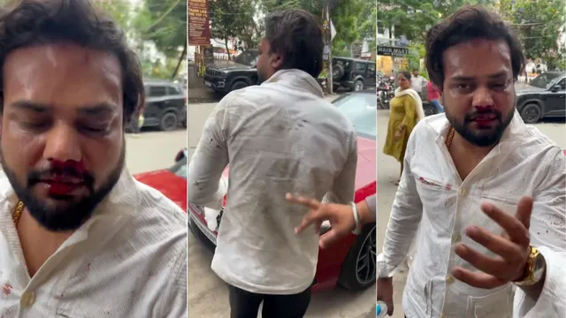 Shocking! Social Media Influencer Deepak Sharma पर हमला, 01 आरोपी गिरफ्तार